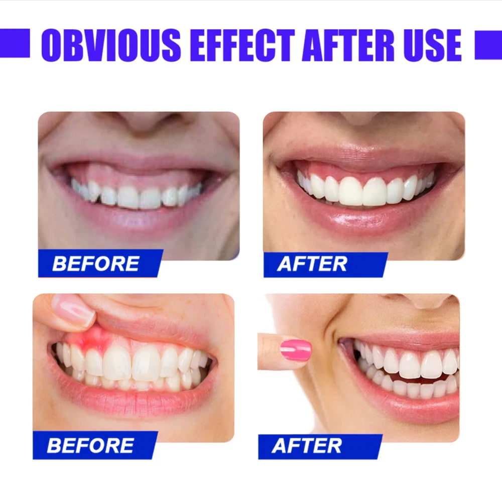 LED Red Light Therapy for Immediate Relief of Tooth Pain Gum Sensitivity Teeth Pain Relief Sore Canker Oral Care Physiotherapy