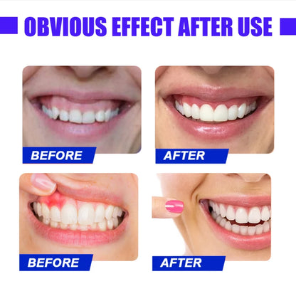 LED Red Light Therapy for Immediate Relief of Tooth Pain Gum Sensitivity Teeth Pain Relief Sore Canker Oral Care Physiotherapy