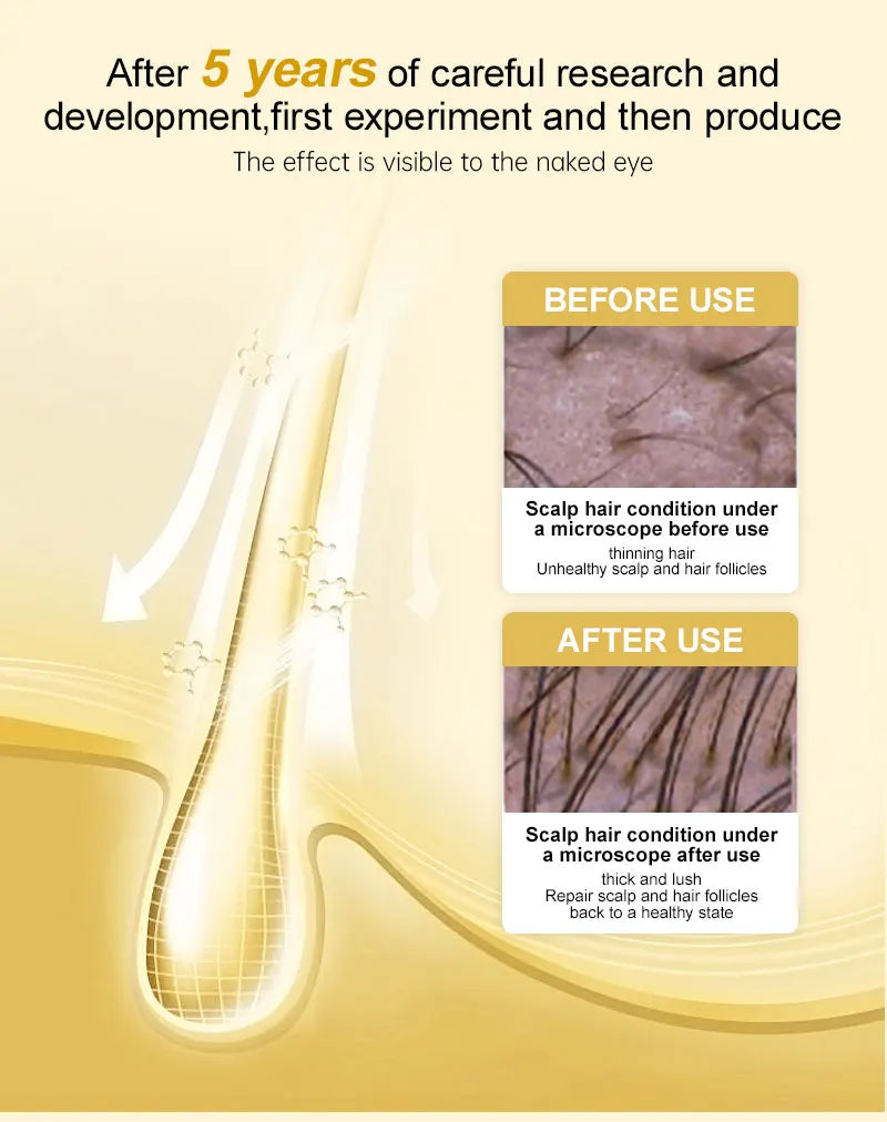 PURC Hair Growth Serum for Men Women Ginger Hair Regrowth Thicken Thinning Hair Loss Treatment Hair Care